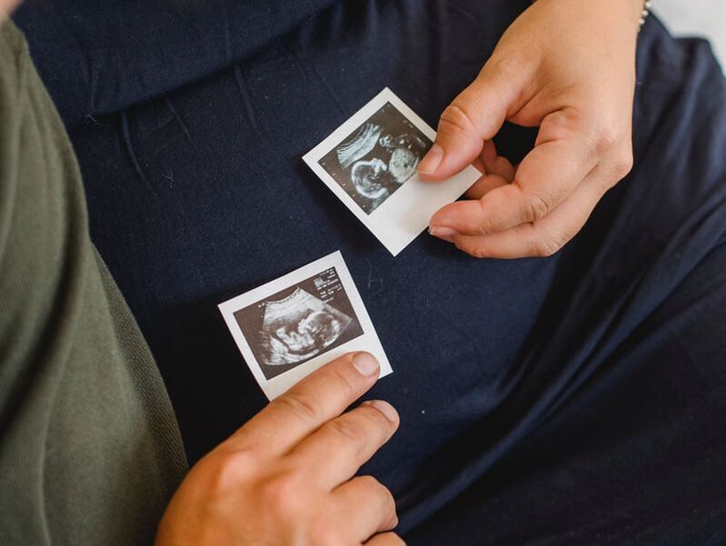 Vanhemmat pitävät käsissään pieniä ultraäänikuvia vauvastaan